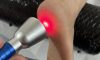 High-Intensity Laser Therapy: Effective Treatment Solutions