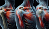 Acupuncture Techniques to Alleviate Frozen Shoulder Pain