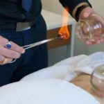 Cupping Therapy Benefits: Discover Healing in Melbourne